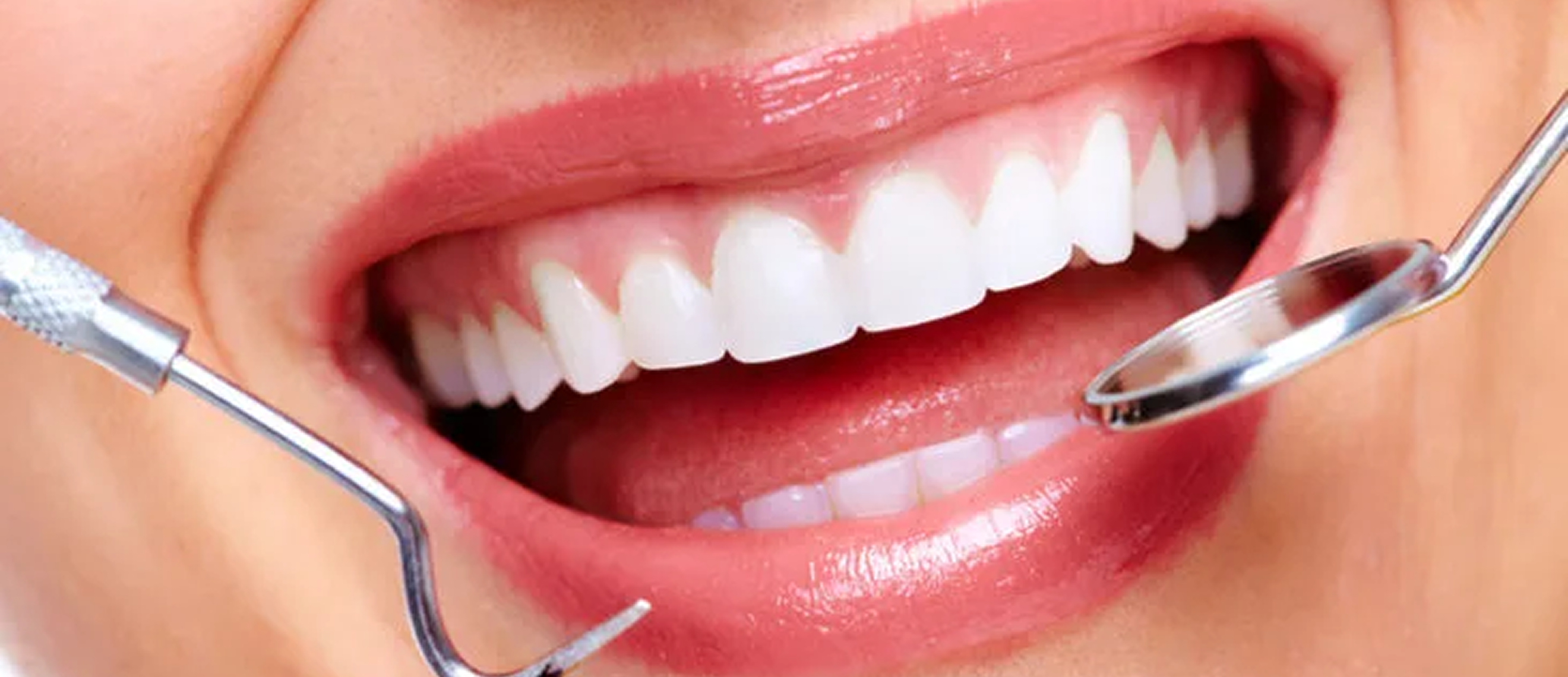 Cosmetic Dentistry in Al Ain - Happy Smile Dental Clinic